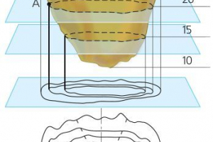 Způsoby, jak nepravidelnosti povrchu zemského povrchu na mapě nebo plánu Způsoby, jak nepravidelnosti povrchu zemského povrchu na mapě nebo plánu